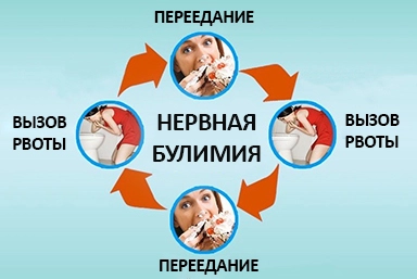 Лечение булимии в Змеиногорске